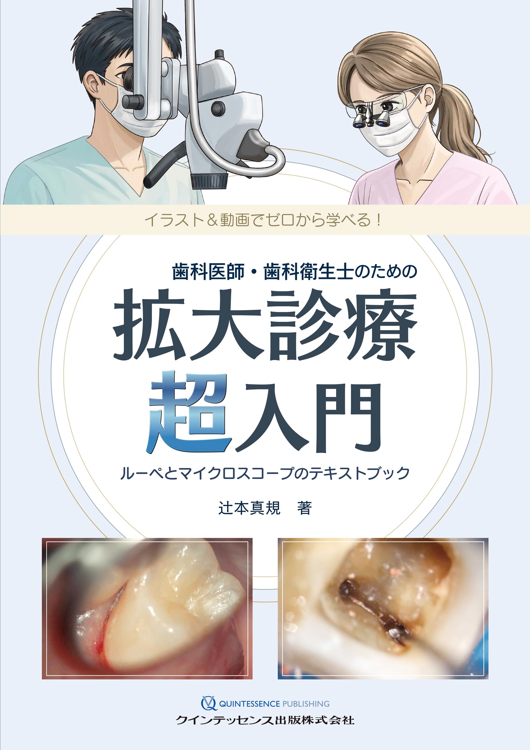 歯科医師・歯科衛生士のための拡大診療 超入門: ルーペとマイクロ